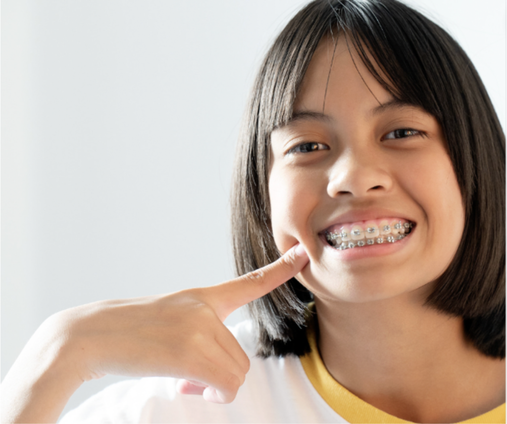 teen smiling and pointing at her braces