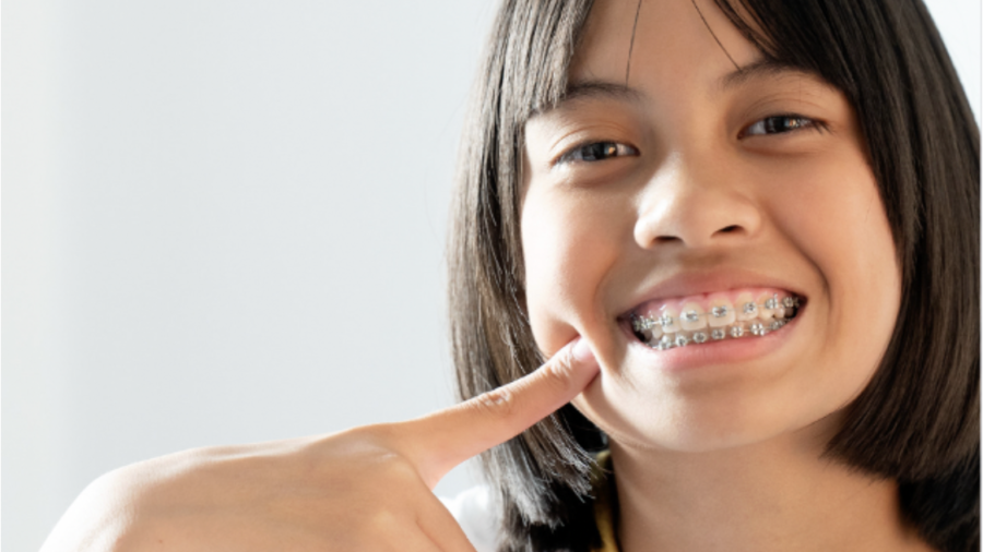 teen smiling and pointing at her braces