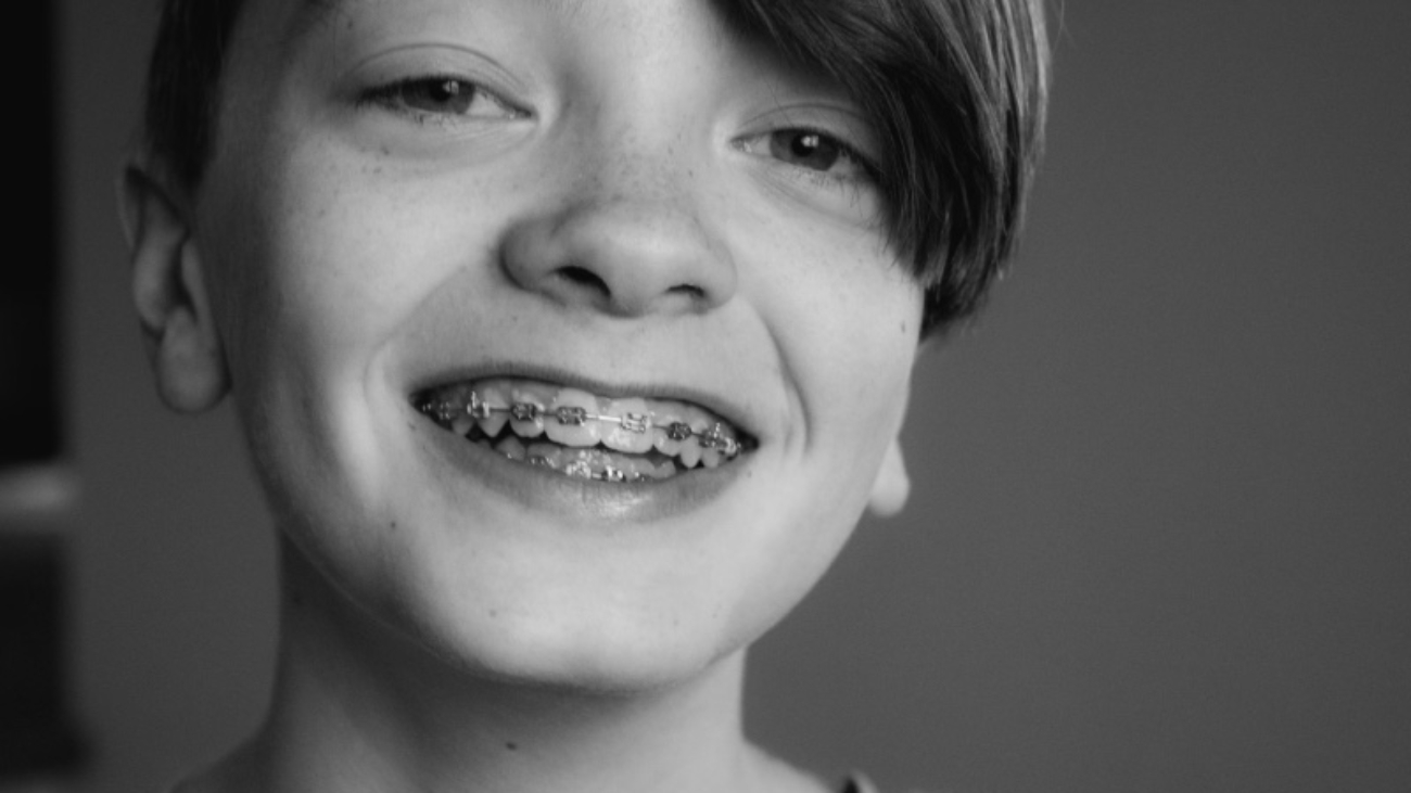 boy smiling with braces